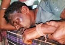 गैस लीकेज से धमाका, युवक झुलसा