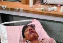 थ्रेसर मशीन में गिरने से किशोर घायल, अजमेर रेफर