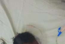 आवारा कुत्तों के हमले में घायल मासूम की मौत