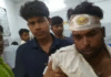 खेत में रोड़ी डालने के विवाद में दो पक्षों में पथराव, कई घायल